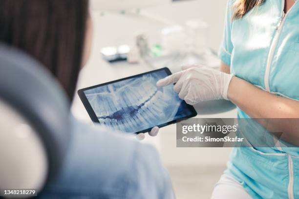 zahnarzt zeigt weiblicher patientin zahnärztliche röntgenaufnahmen - zahnarzthelfer stock-fotos und bilder