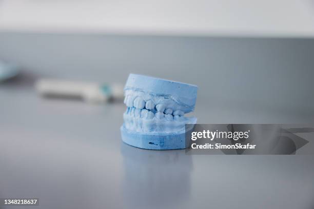 gypsum model of human jaw on table - crown molding bildbanksfoton och bilder