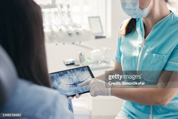 close up of dentist showing dental x-ray to patient - orthodontist stock pictures, royalty-free photos & images