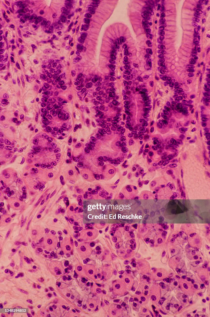 STOMACH--MUCOSA, GASTRIC GLANDS, GASTRIC PITS, PARIETAL CELLS, CHIEF CELLS, MUCOUS CELLS, 100X