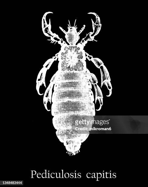old engraved illustration of insect, head louse (pediculus humanus capitis) - humanus capitis stock pictures, royalty-free photos & images