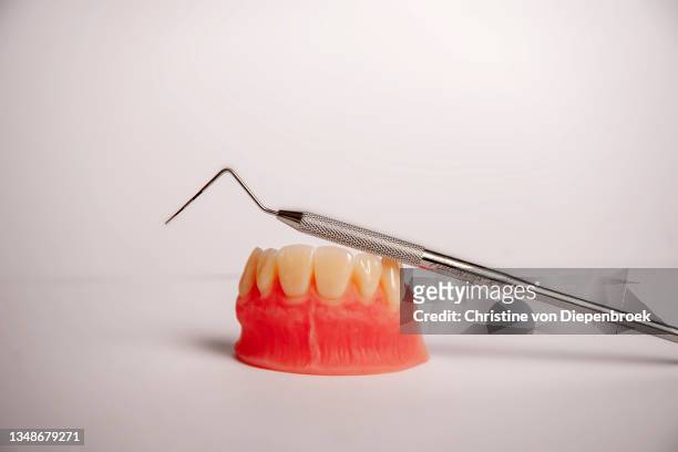 periodontal probe and teeth - parodontitis stockfoto's en -beelden