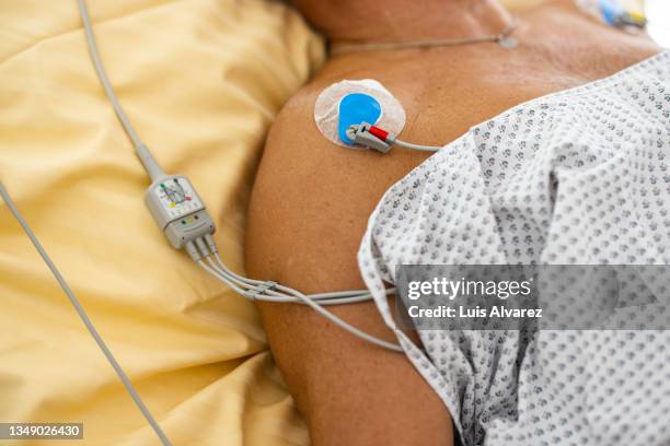 senior male patient lying on the bed connected to the ecg machine - electrode stock pictures, royalty-free photos & images