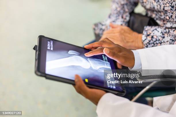 close-up of a doctor sharing the treatment from the x-ray scan on digital tablet with a patient - knees together fotografías e imágenes de stock