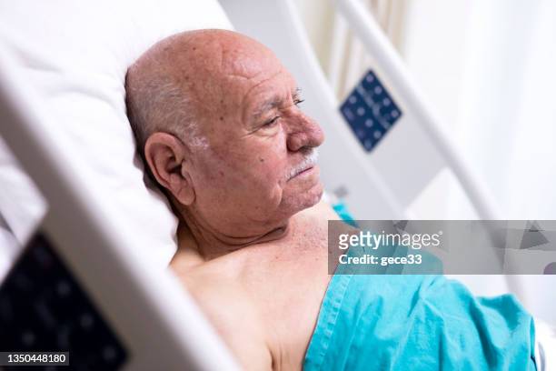 sick and senior man wearing hospitable gown lying in bed - hospital gown imagens e fotografias de stock