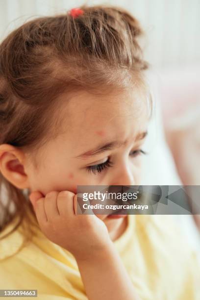 children viral disease or allergies. red measles rash on little girl. - measles stock pictures, royalty-free photos & images