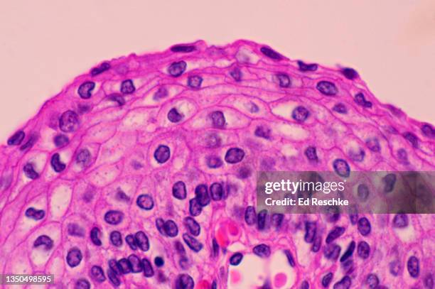 non-keratinized stratified squamous epithelium---esophagus, human 250x - lamina propria fotografías e imágenes de stock