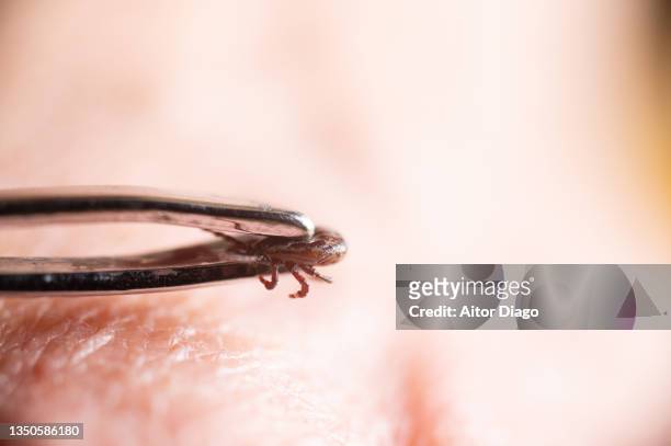 tweezers holding a tick on a person's skin. germany - nehmen stock-fotos und bilder