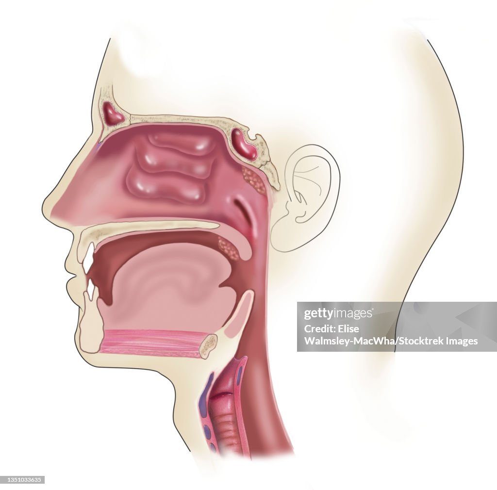 Side view of head showing location of swollen and enlarged tonsils.