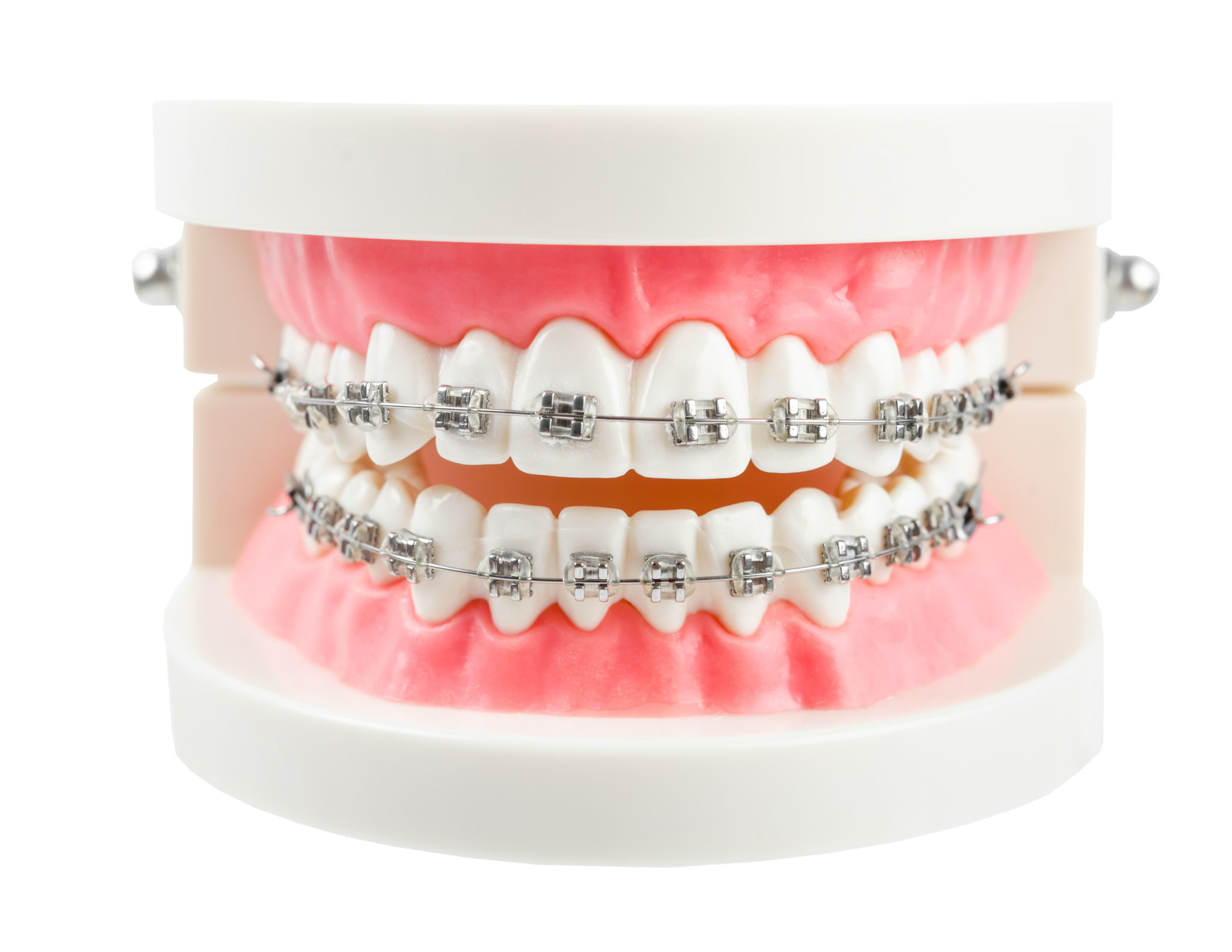 orthodontic model