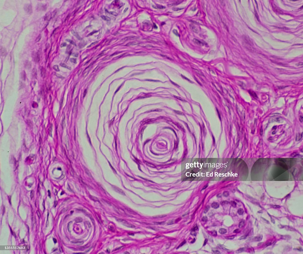SENSORY RECEPTOR--PACINIAN CORPUSCLE in the SUBCUTANEOUS LAYER of the SKIN, 200X