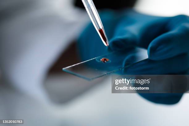 labortechniker, der einen tropfen blut mit einer pipette auf einen objektträger legt - lab closeups stock-fotos und bilder