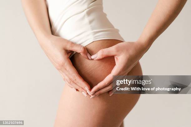 body positive, young adult woman with stretch marks self love heart on hip, after massage beauty spa body care procedure - parte del corpo foto e immagini stock