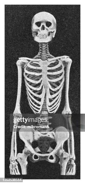 old engraved illustration of a female skeleton deformed by wearing a corset - costela osso humano - fotografias e filmes do acervo