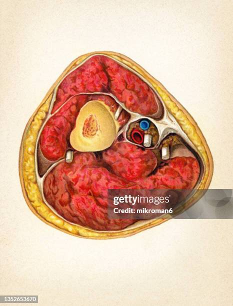 old chromolithograph illustration of surgical operation, cross section of the human arm - aorta fotografías e imágenes de stock