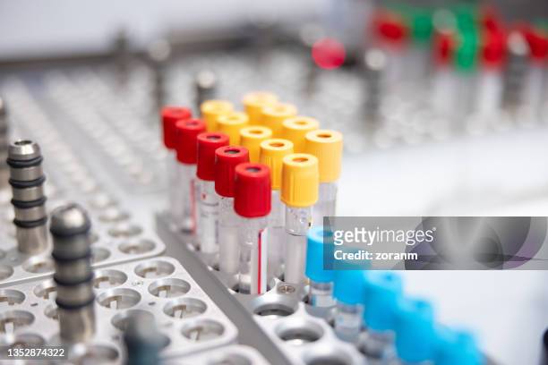 sampling tubes on a rack - blood tubes stock pictures, royalty-free photos & images