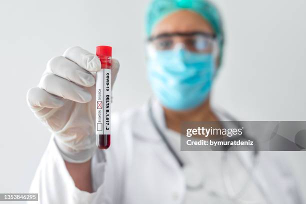blood sample with covid-19 delta variant - antibody testing imagens e fotografias de stock