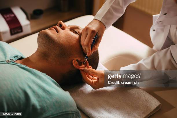 man having an acupuncture treatment on his ear - acupuncture needle 個照片及圖片檔