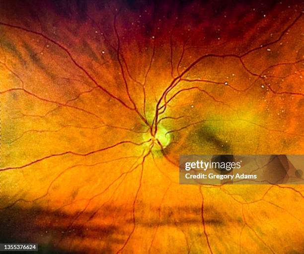 an image of a human retina taken during an eye exam - vergrößerung stock-fotos und bilder