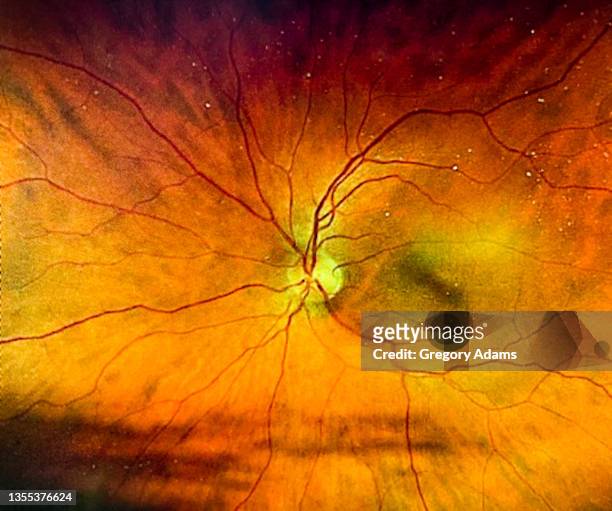 an image of a human retina taken during an eye exam - retina stock pictures, royalty-free photos & images