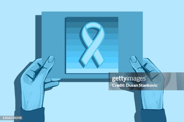 prostate cancer - prostate stock illustrations