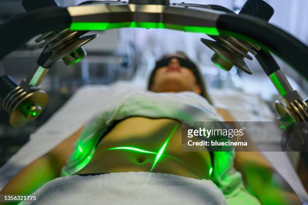 laser slimming treatment - liposuction stock pictures, royalty-free photos & images