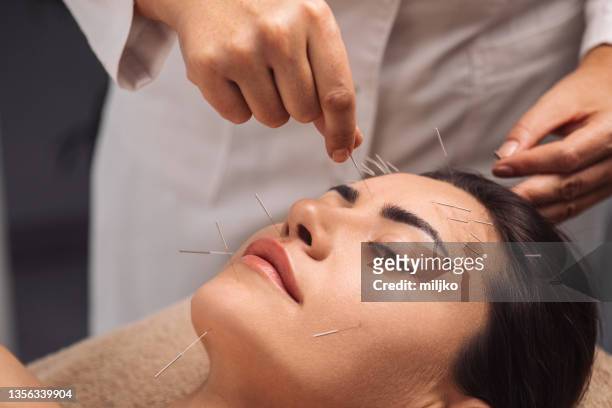 acupuncture traitement du visage - acupuncture photos et images de collection