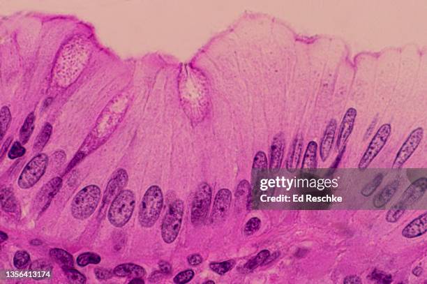 simple columnar epithelium and goblet cells, human appendix, 250x - simple columnar epithelial cell stock pictures, royalty-free photos & images