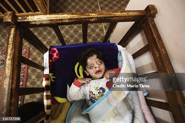 Disabled orphan Farah rests in the orphanage where she lives on December 13, 2011 in Baghdad, Iraq. Farah was abandoned at birth by her parents at...