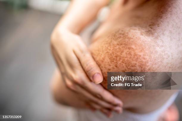close-up of a shoulder of a adult woman at spa - pele imagens e fotografias de stock