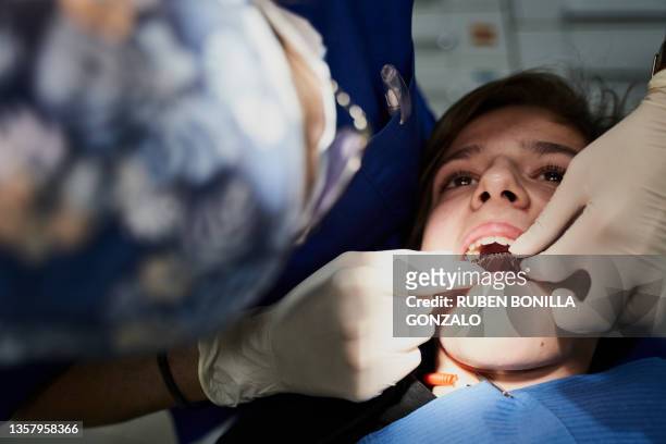 caucasian boy with a teeth bridge in dental surgery opening his mouth for exam by dentist. healthcare and medicine concept. - gonzalo caballero fotografías e imágenes de stock