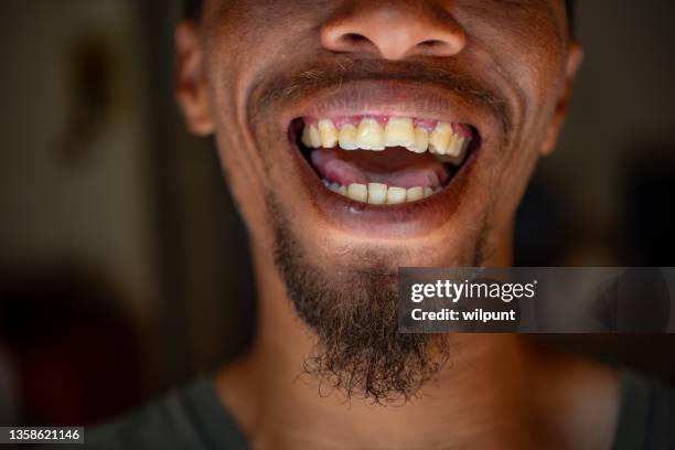 Florida Rapper Teeth 391 Rapper Teeth Stock Photos, High-Res Pictures, and Images - Getty Images