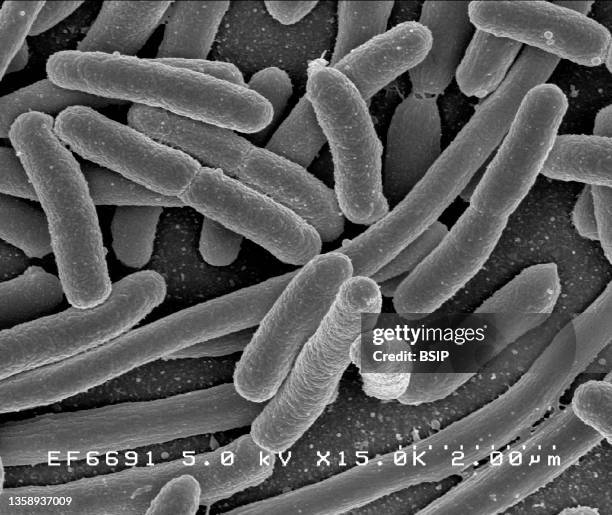 Scanning electron micrograph of Escherichia coli, grown in culture and adhered to a cover slip.