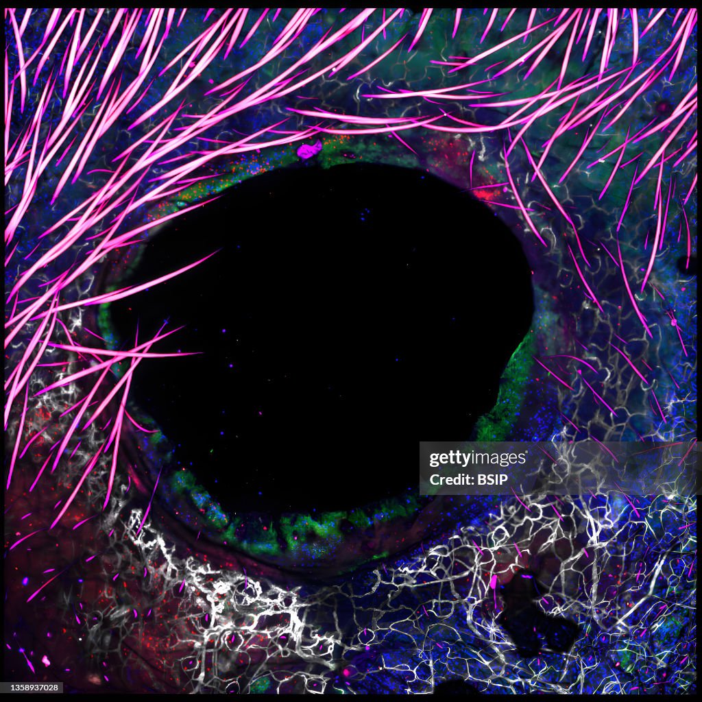 Cd8 t cells close to wound after staphylococcus epidermidis application