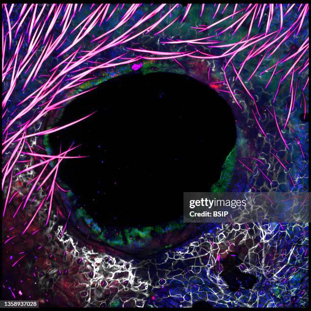 Cells localize to sites of injury in skin following commensal colonization.