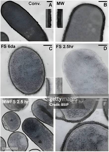 Bacillus Tem Transmission Electron Microscopy Photos and Premium High Res Pictures ...