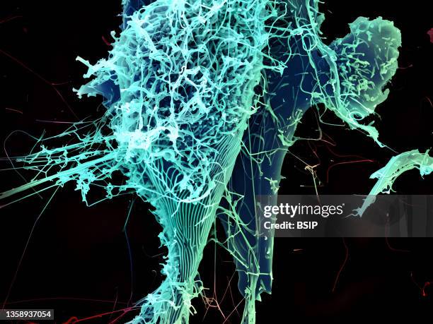 String-like Ebola virus particles are shedding from an infected cell in this electron micrograph.