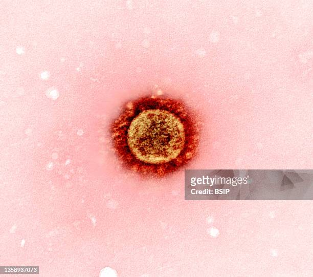 Transmission electron micrograph of a SARS-CoV-2 virus particle , isolated from a patient sample and cultivated in cell culture. Image captured at...