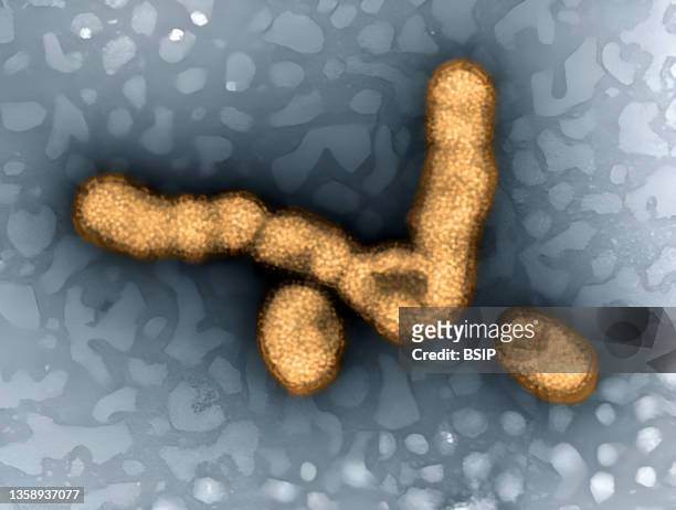 Colorized transmission electron micrograph showing H1N1 influenza virus particles.