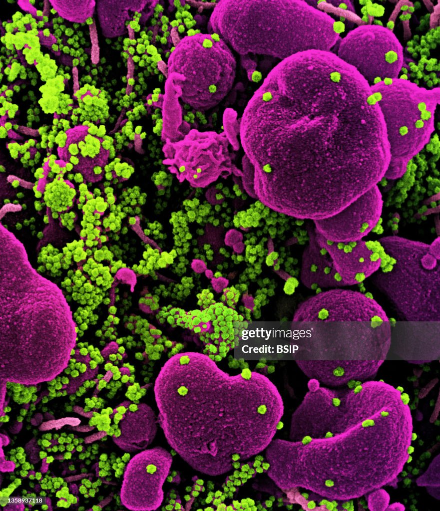Novel coronavirus sars-cov-2