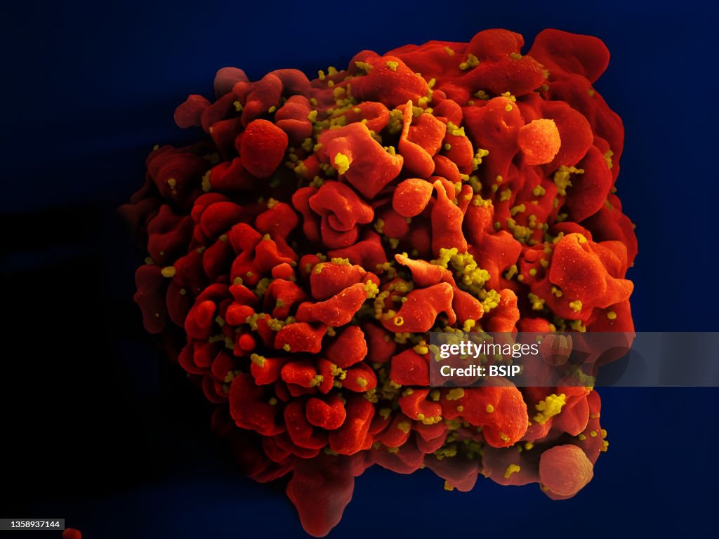 Hiv-infected h9 t cell