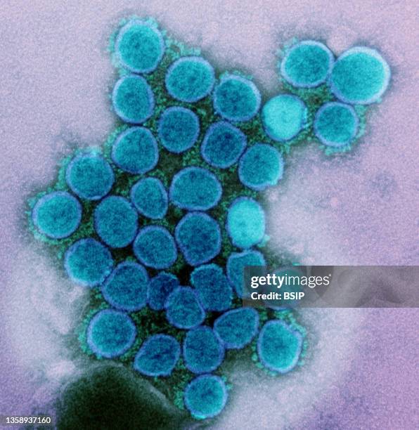 Transmission electron micrograph of a variant strain of SARS-CoV-2 virus particles , isolated from a patient sample and cultivated in cell culture....