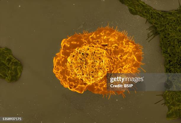 Colorized scanning electron micrograph of a macrophage.