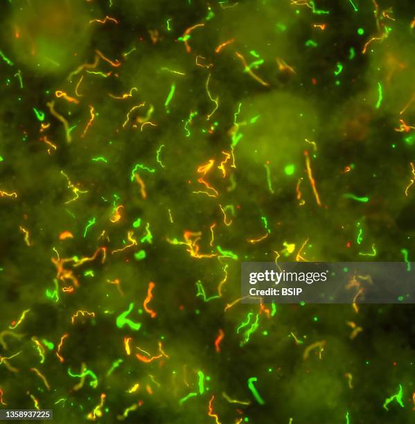 The Lyme disease spirochete, Borrelia burgdorferi, is an obligate parasite that cycles between ticks and vertebrate hosts. B. Burgdorferi alters the...