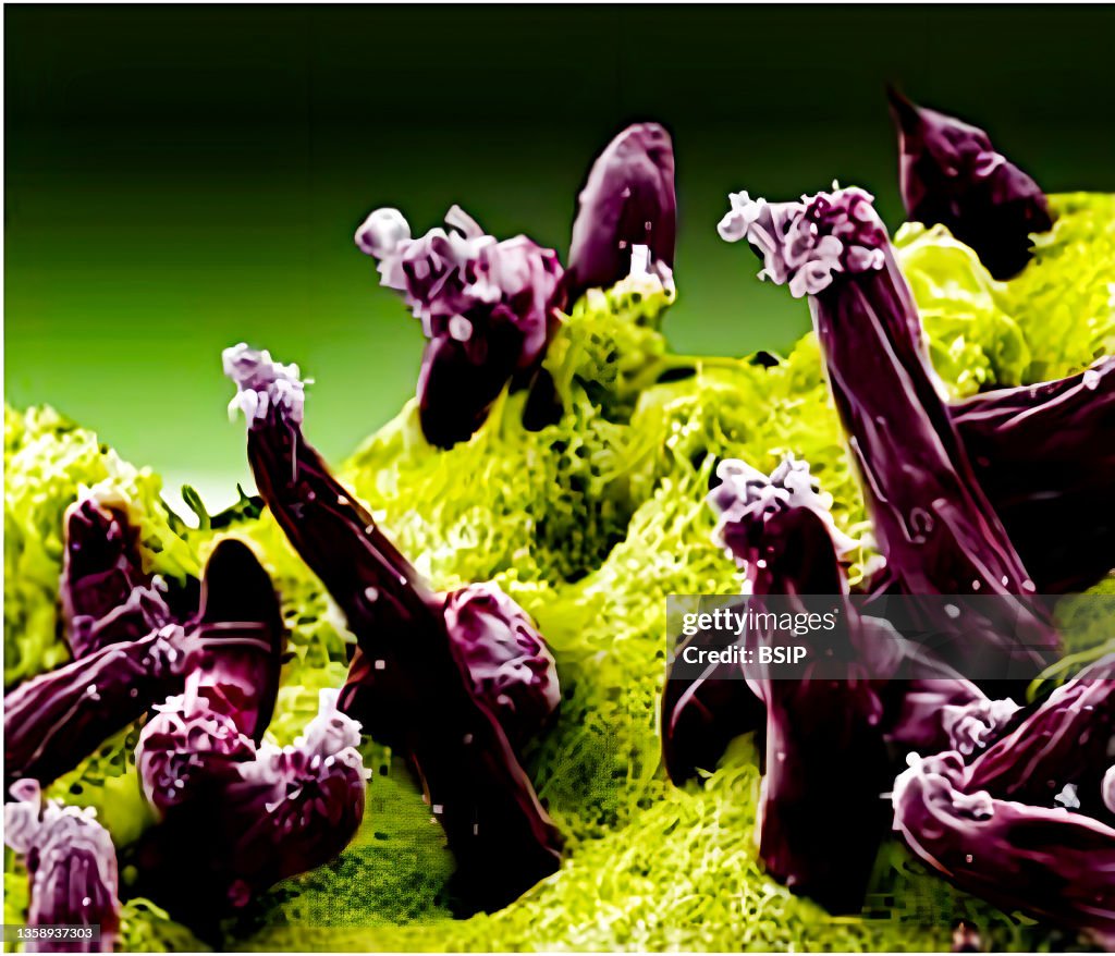 Malaria: plasmodium gallinaceum