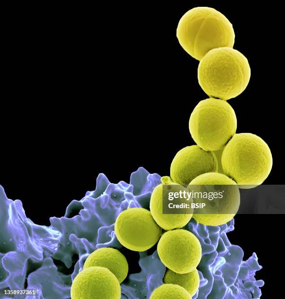 Or Methicillin-Resistant Staphylococcus Aureus being ingested by neutrophil .