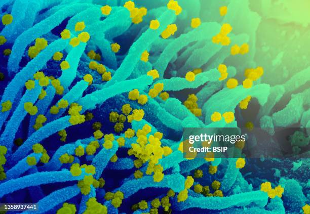 This scanning electron microscope image shows SARS-CoV-2 emerging from the surface of a cell cultured in the lab. SARS-CoV-2, also known as...