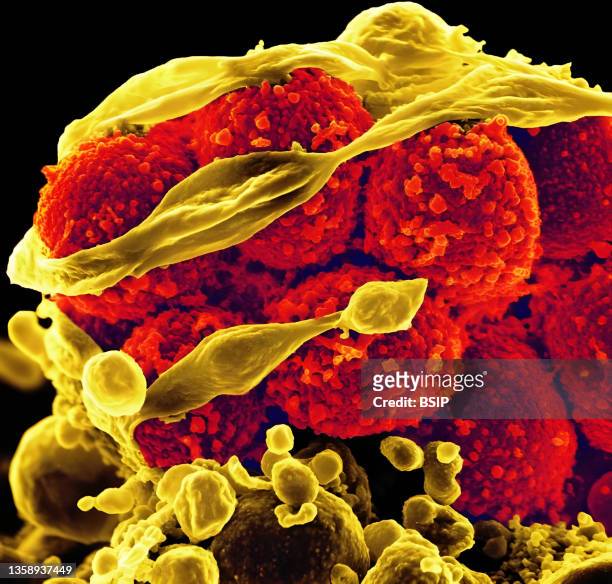 Scanning electron micrograph of methicillin-resistant Staphylococcus aureus bacteria killing and escaping from a human white cell.