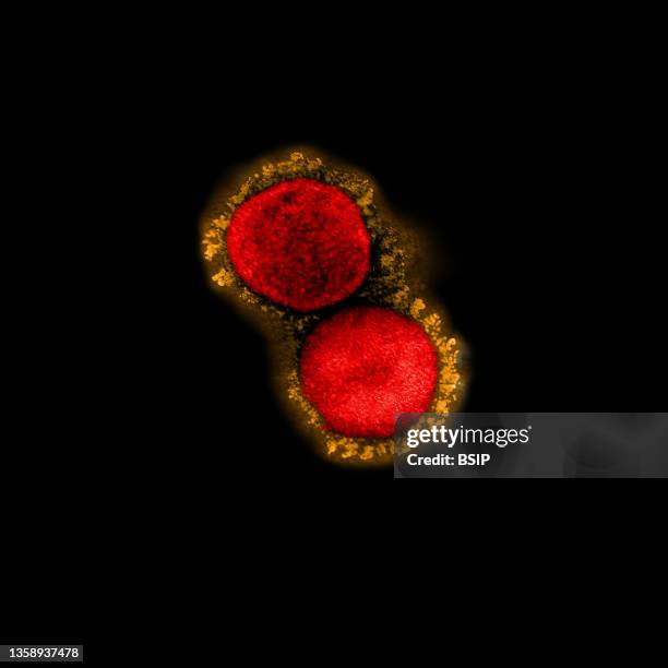 Transmission electron micrograph of SARS-CoV-2 virus particles , isolated from a patient sample and cultivated in cell culture. Image captured at the...