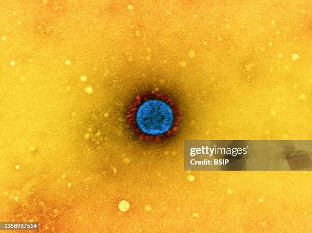 Transmission electron micrograph of a SARS-CoV-2 virus particle , isolated from a patient sample and cultivated in cell culture. The prominent...